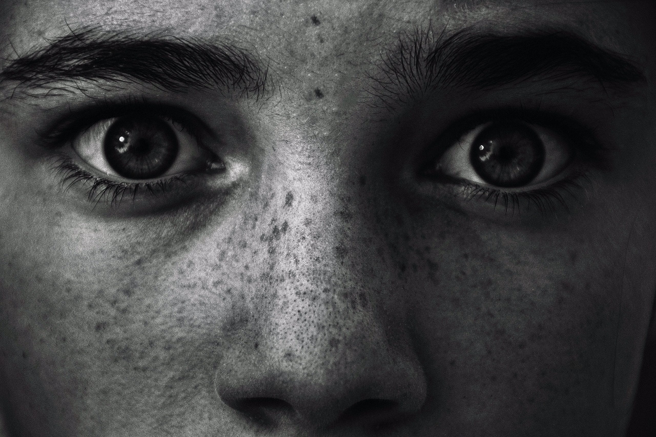Overcome Staring OCD